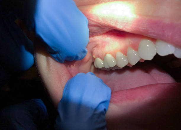 Best Emergency Dentist for Special Needs Patients in Cloverdale, VA