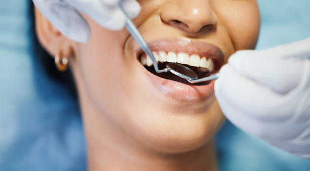 Best Broken or Cracked Tooth Emergency Dentist in Cloverdale, VA