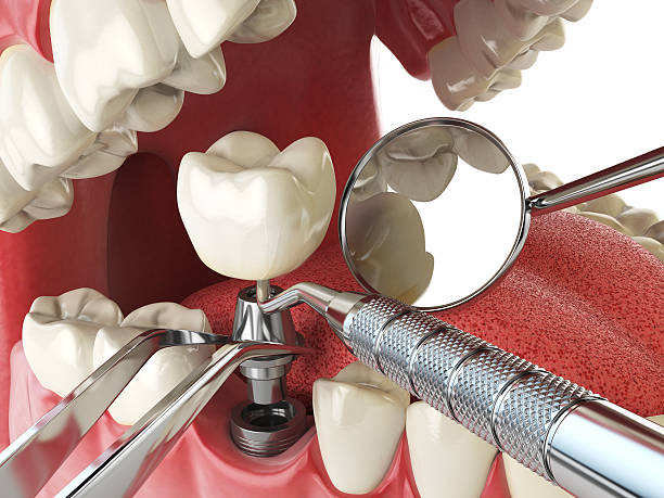 Best Urgent Dental Care for Toothache in Cloverdale, VA