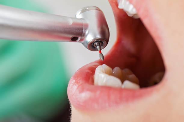 Best Emergency Cosmetic Dentistry in Cloverdale, VA